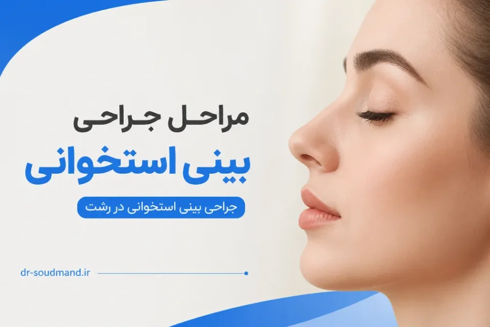 نمای توضیحی درباره مراحل جراحی بینی استخوانی
