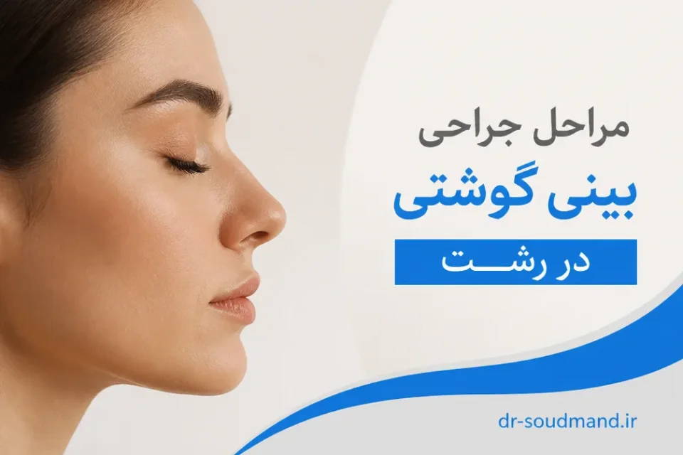 نمای توضیحی درباره مراحل جراحی بینی گوشتی